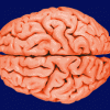 wet_brain wet_brain