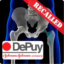 hip replacement recall